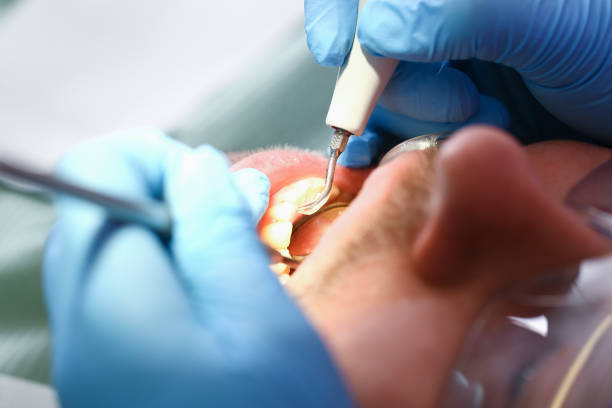 Best Dentist for Tooth Abscess  in Marlow Heights, MD